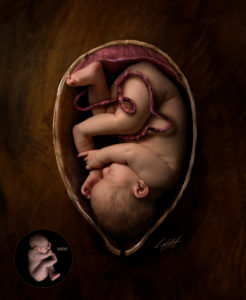 Womb Placenta & Umbillical Cord