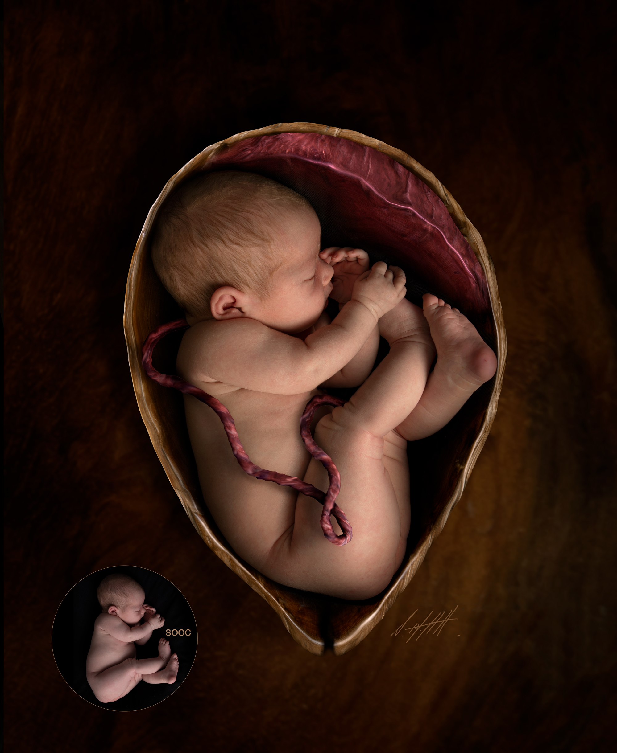 Womb Placenta & Umbillical Cord
