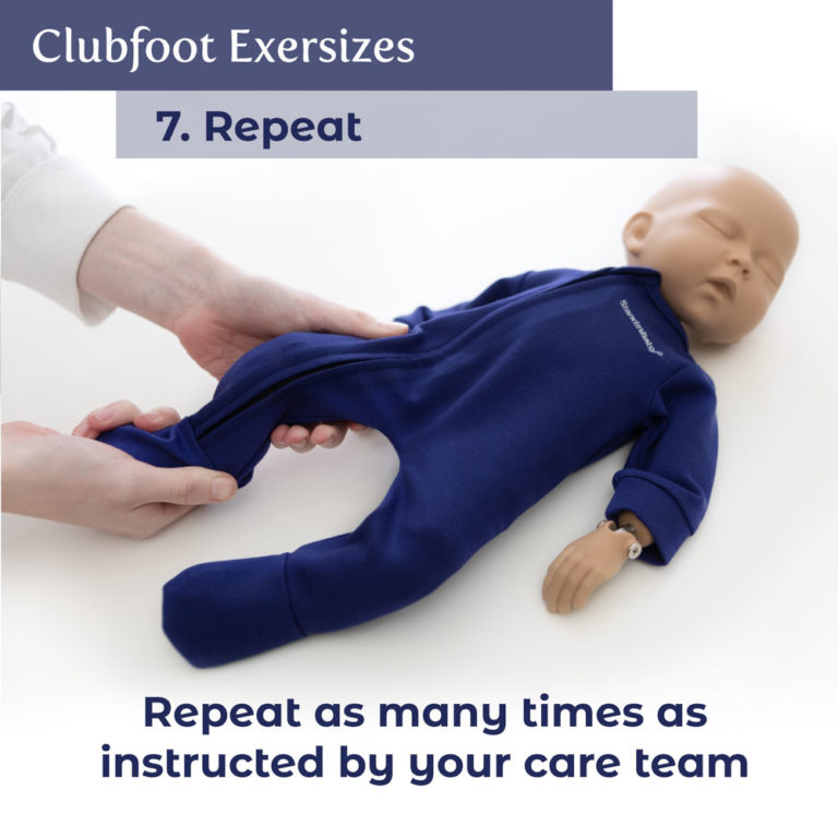 Clubfoot Exercises StandInBaby®