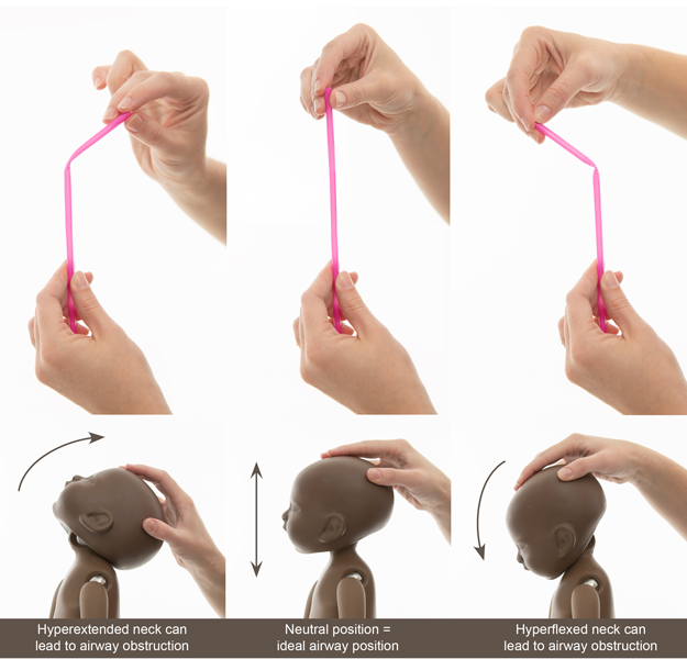 Positional asphyxiation in Newborn photography